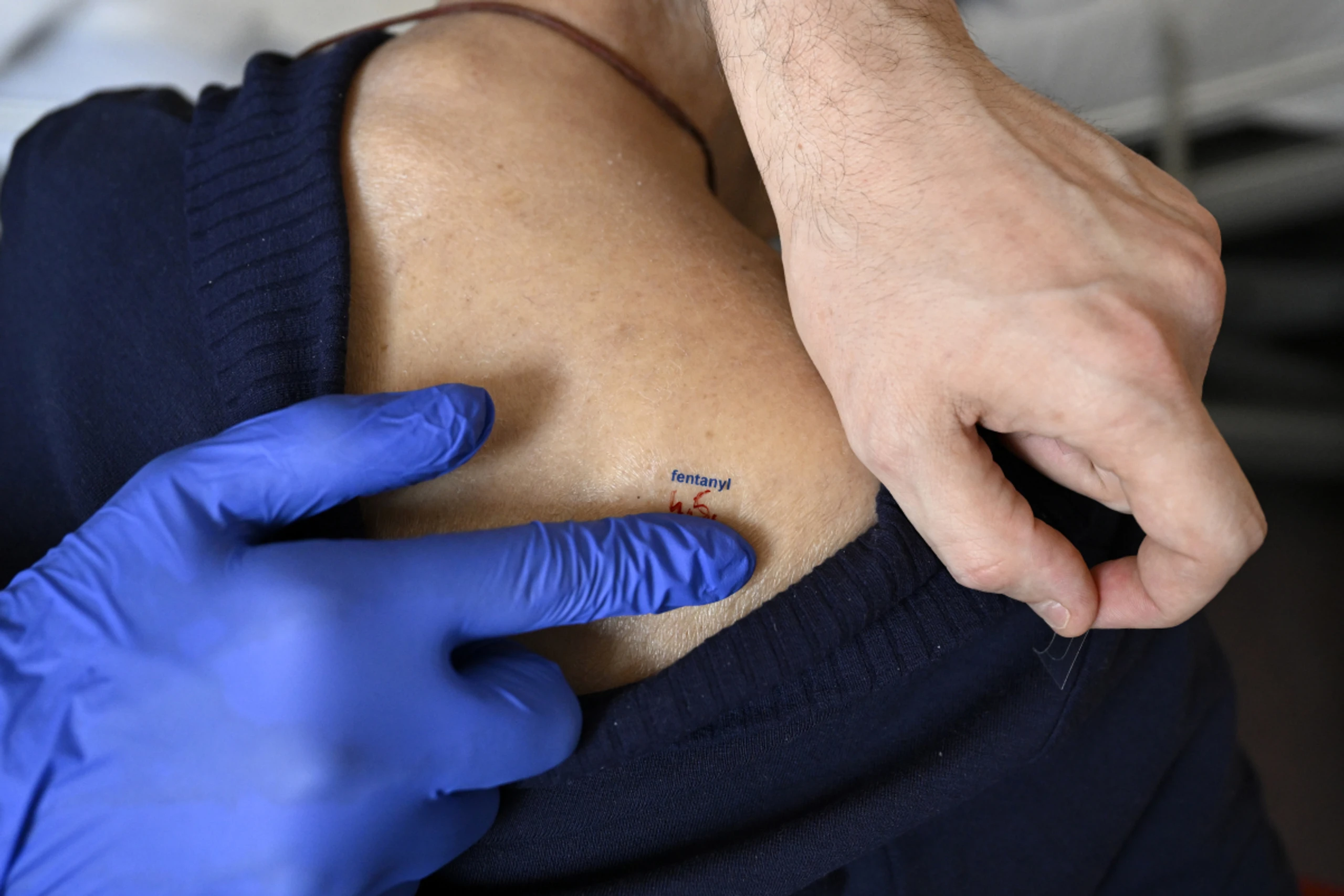 Rasche Diagnose für Behandlung wichtig