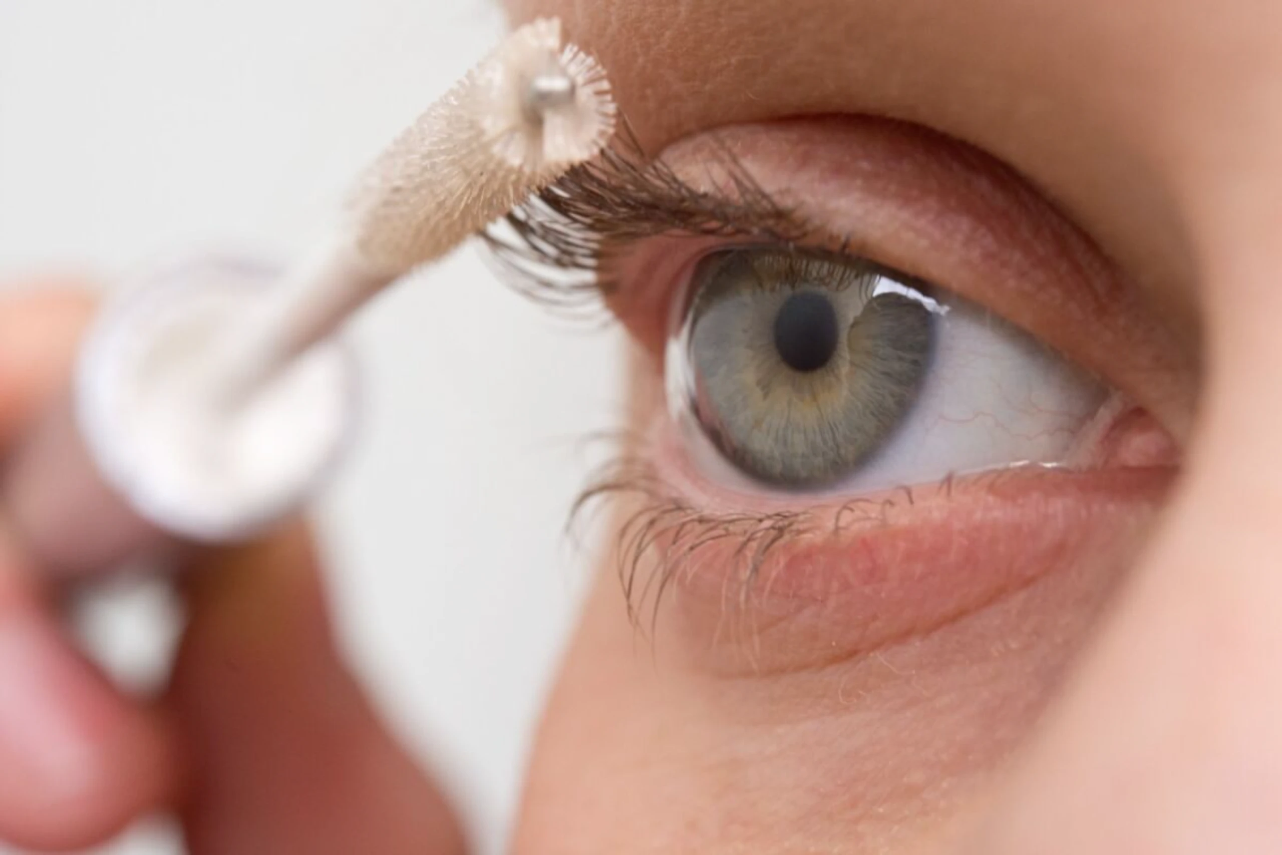 Die Haut unter den Augen kann mit der Zeit mehr Melanin einlagern