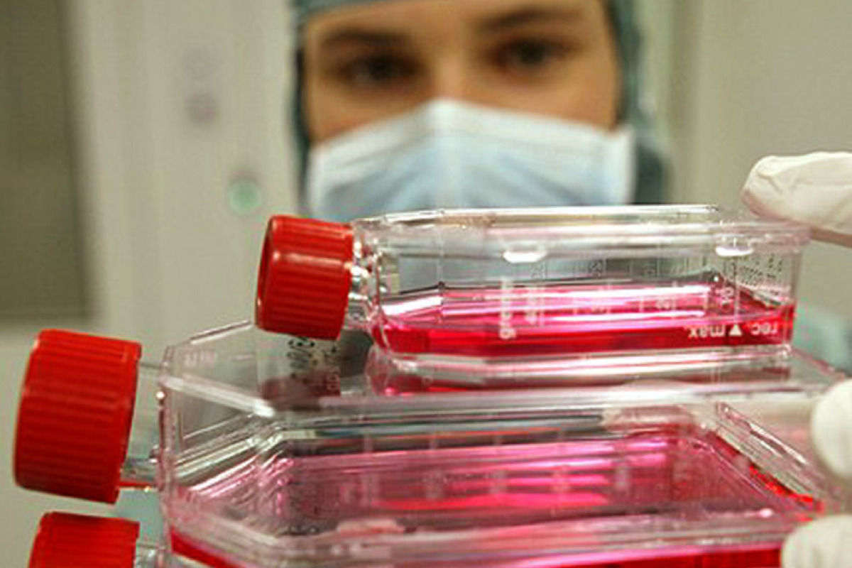 Dialysespezialist bestätigt Prognosen