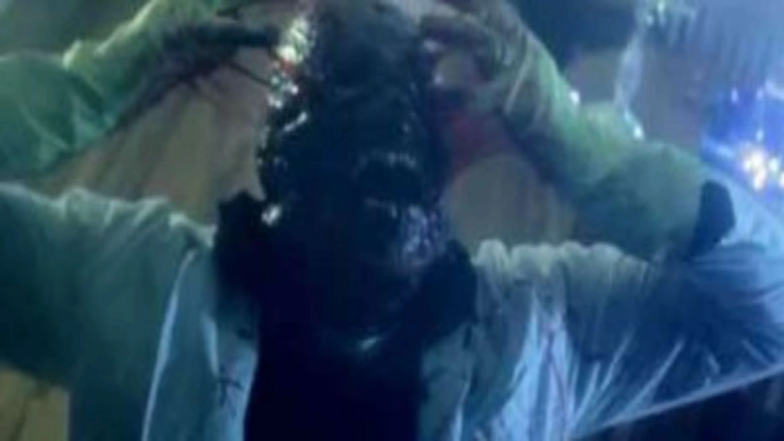 The Ballad of Skinless Pete