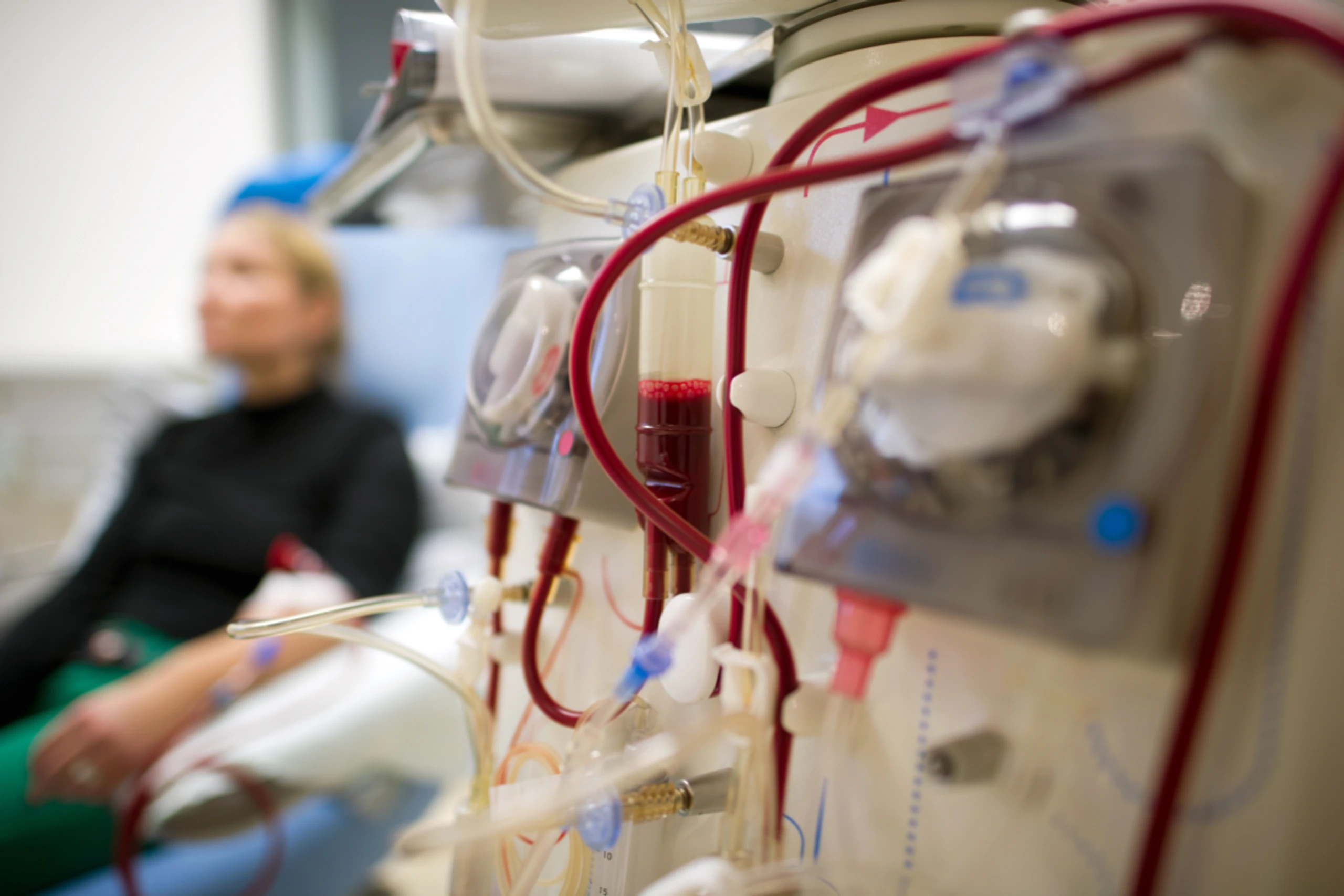 Dialysepatienten haben oft mit zusätzlichen Komplikationen zu tun