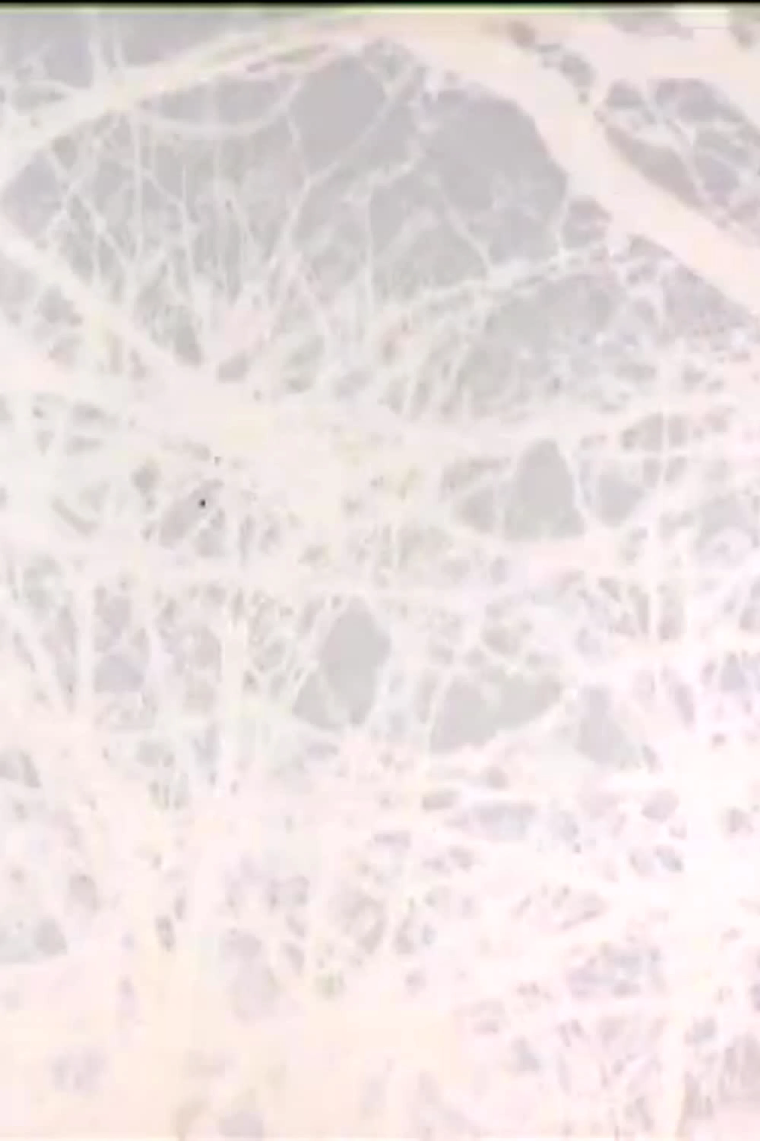Leafless