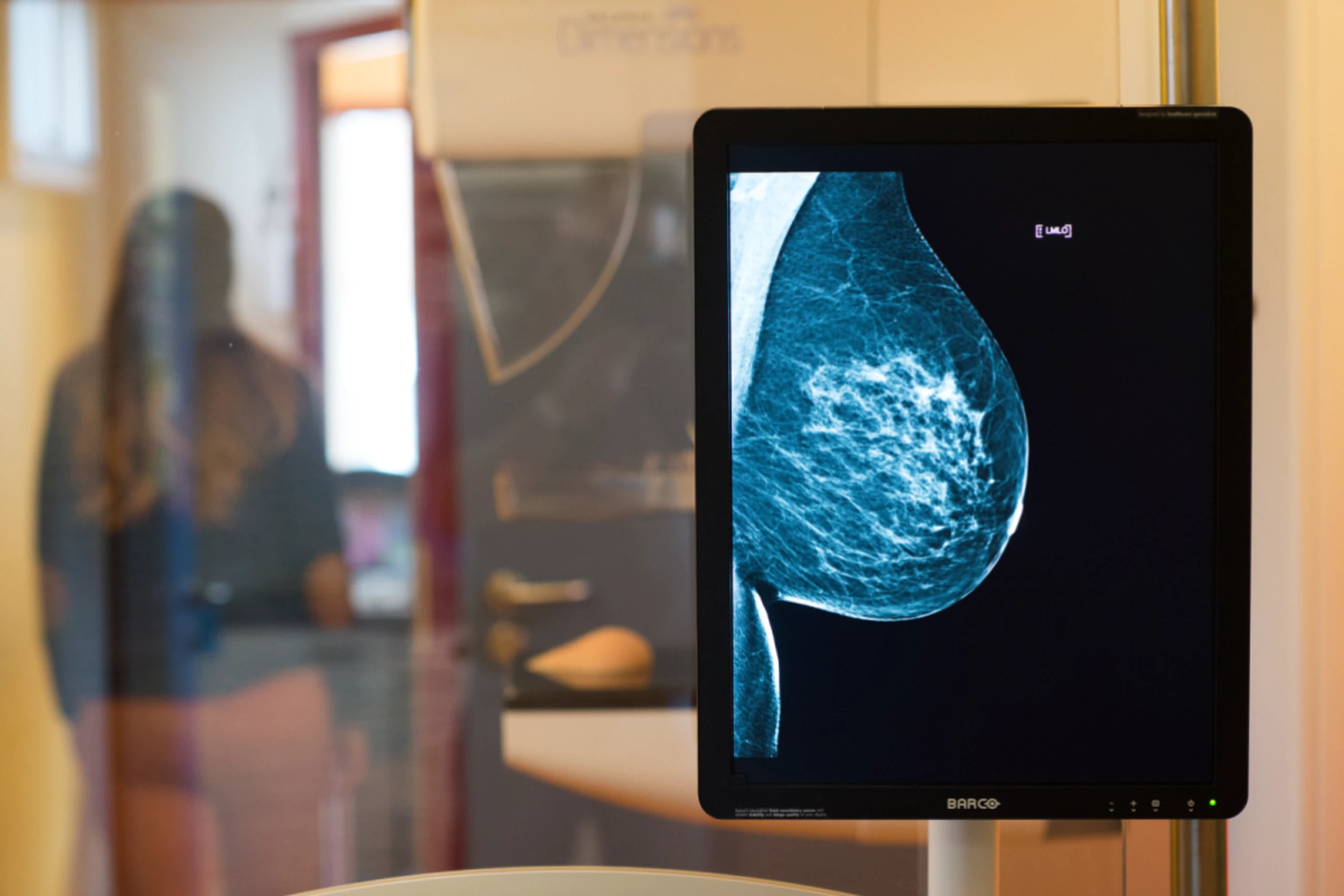 In Österreich werden jährlich 800.000 Mammografien durchgeführt