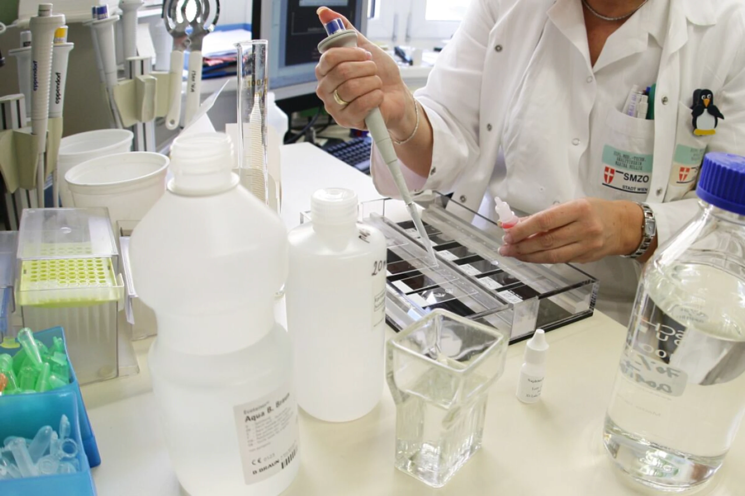 Autoimmunprozesse sollen gezielt gestoppt werden