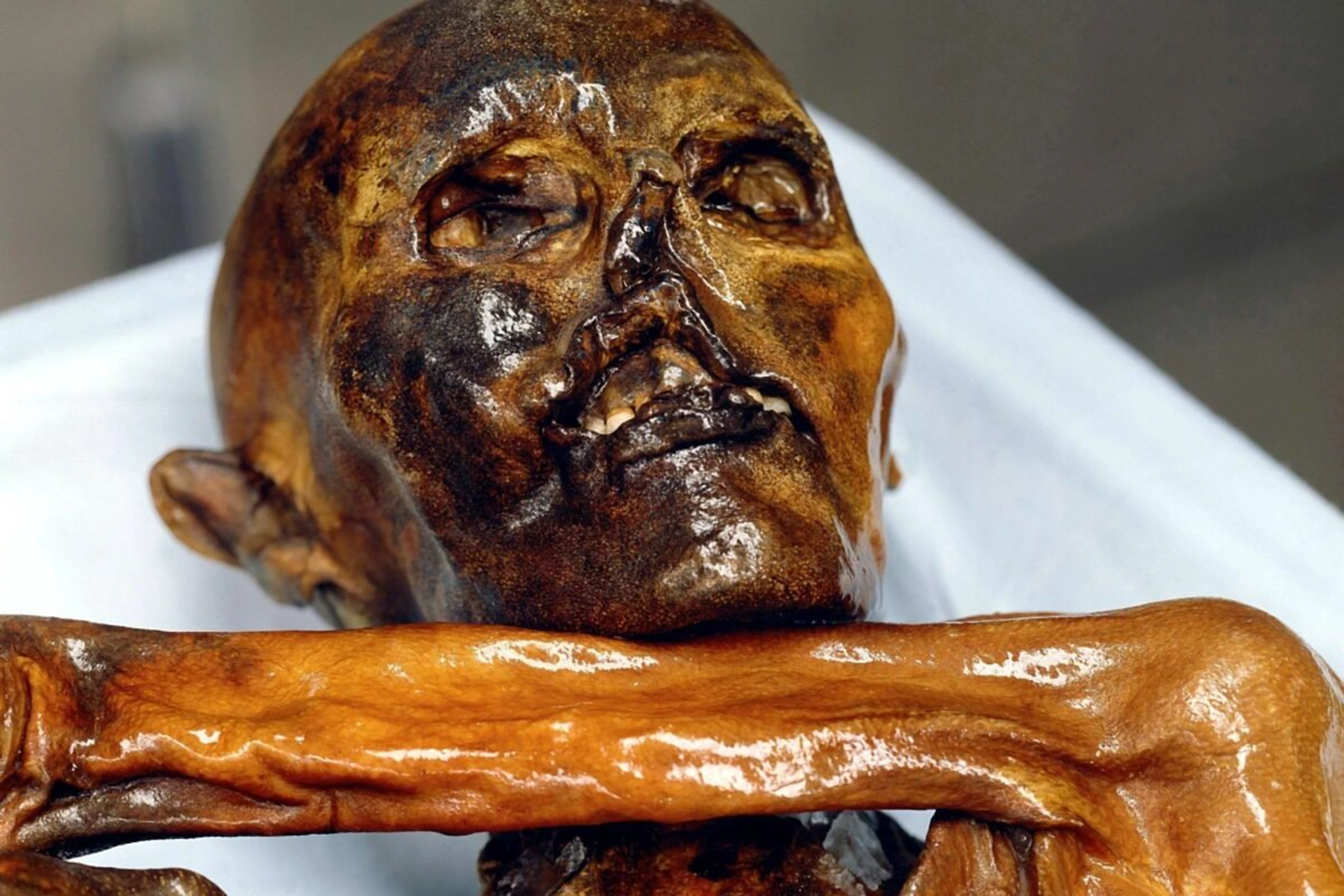 Der "Ötzi" wird die Forschung noch viele Jahrzehnte beschäftigen