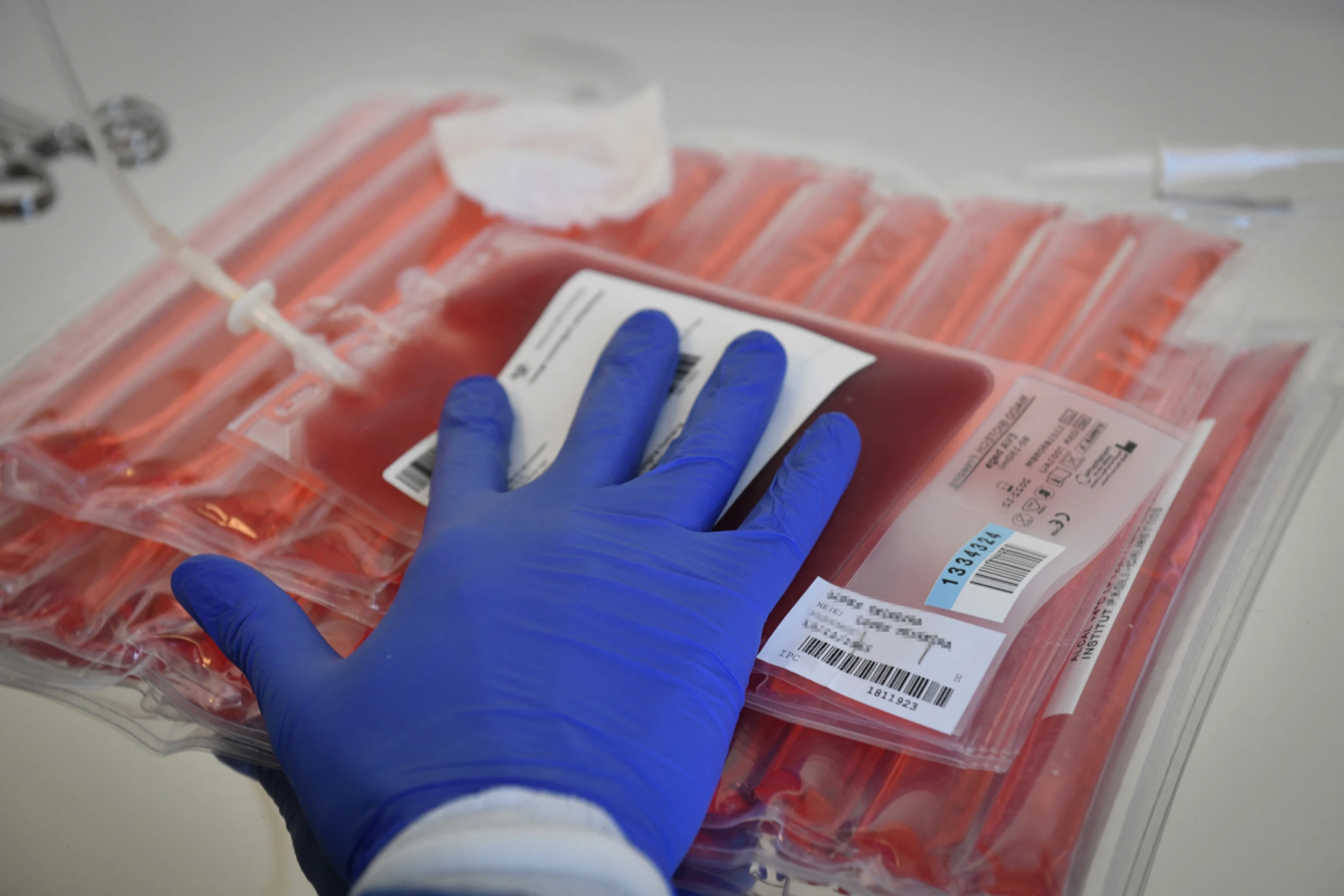 CAR-T-Zellen machen "eigenes Immunsystem scharf" gegen Krebs