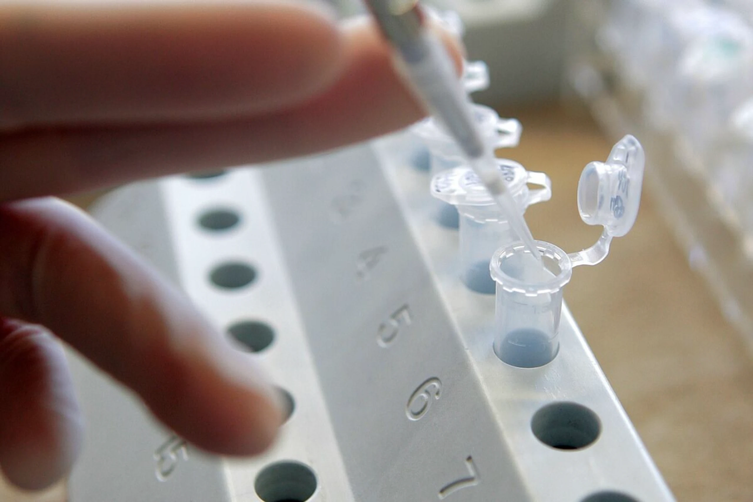 Preis geht an Weiterentwicklung sicherer RNA-Therapeutika